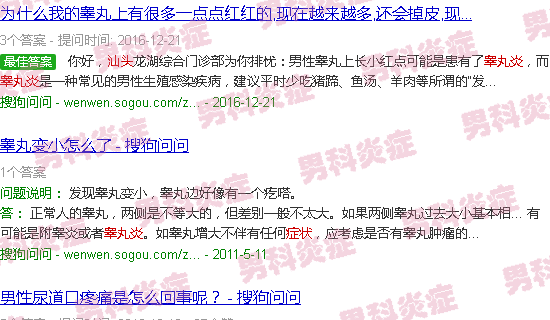 汕头睾丸炎症状