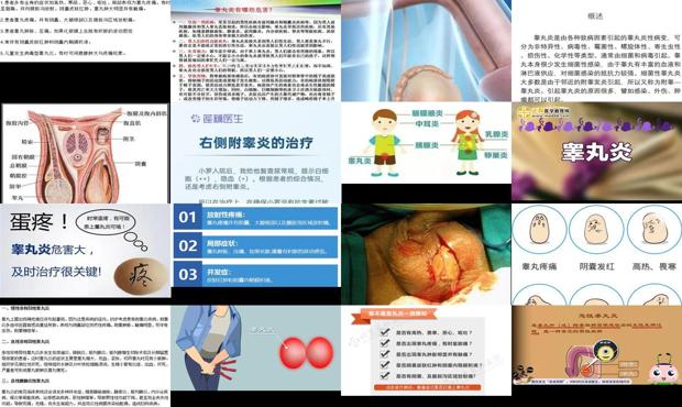 睾丸炎有什么症状表现 - 汕头睾丸炎症状