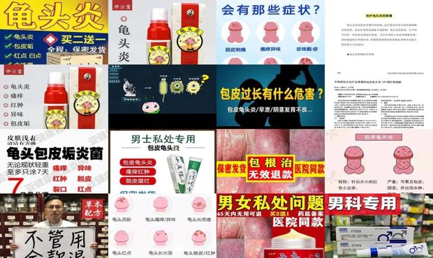 汕头龟头炎症治疗
