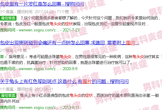 汕头龟头炎症状图片大*