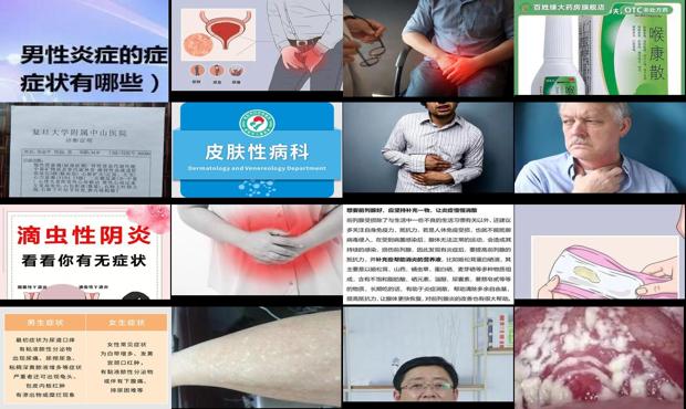 男人炎症感染 - 汕头男人炎症症状