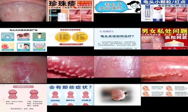 汕头包皮炎症医院排名 - 汕头包皮炎症