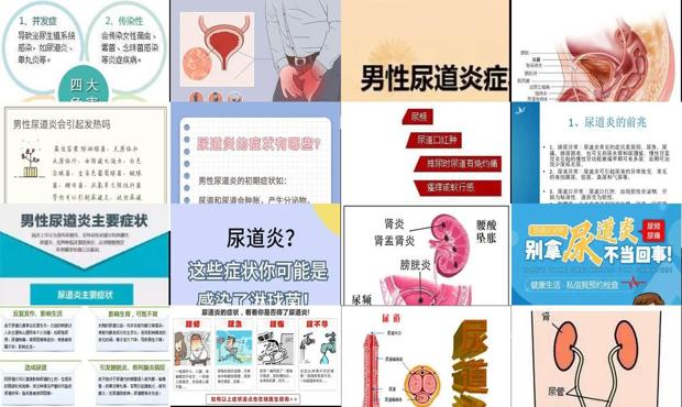 尿道炎症状表现百度 - 汕头尿道炎症状表现男性