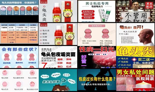 汕头治疗男科医院哪家好 - 汕头龟头有炎症怎么治疗