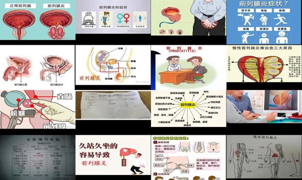广州慢性前列腺炎 - 汕头慢性前列腺炎症