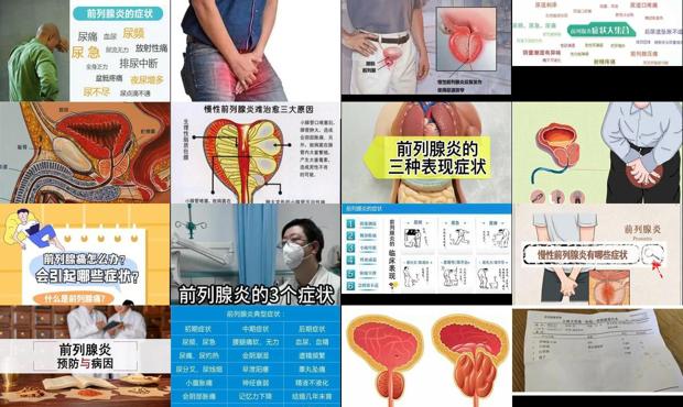 汕头前列腺炎症状表现哪些