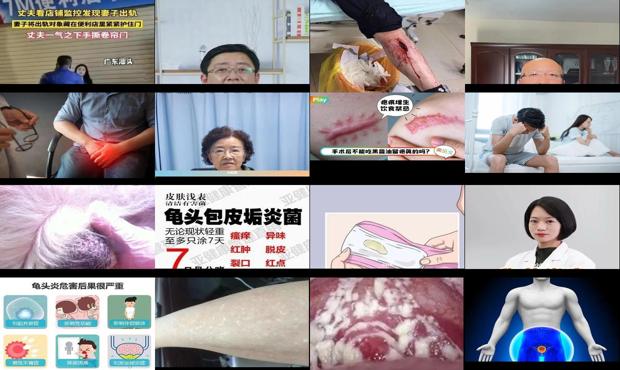 汕头男人有炎症