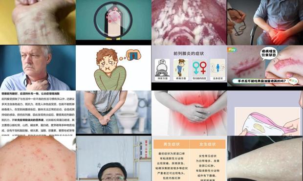 男人炎症感染哪些症状 - 汕头男人炎症什么症状