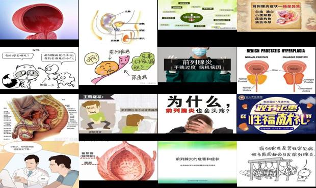 汕头前列腺炎症