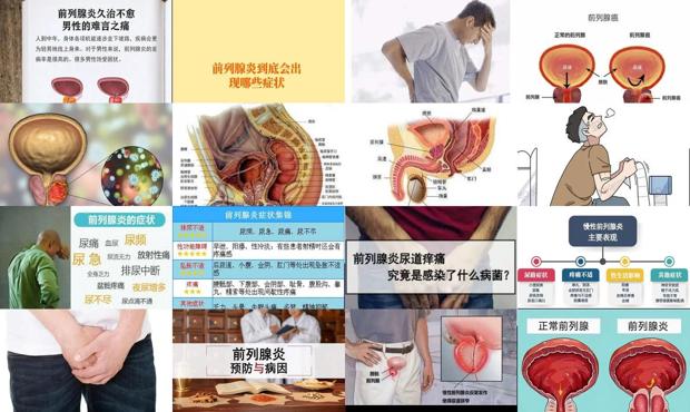 男性前列腺的保养方法 - 汕头男性前列腺炎症状