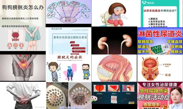 膀胱尿道炎是什么症状 - 汕头尿道炎膀胱炎症状