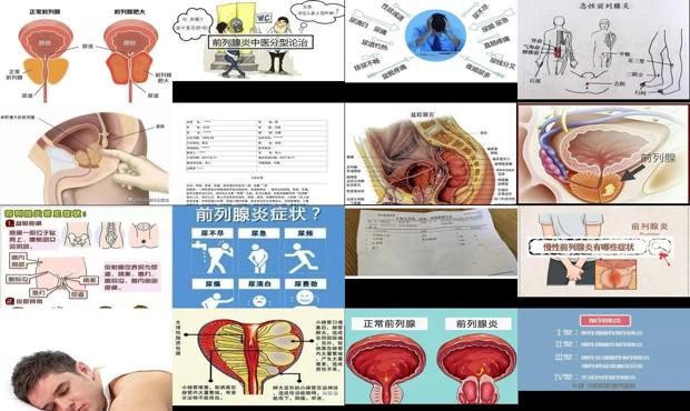 急性前列腺挂什么科 - 汕头急性前列腺炎症状