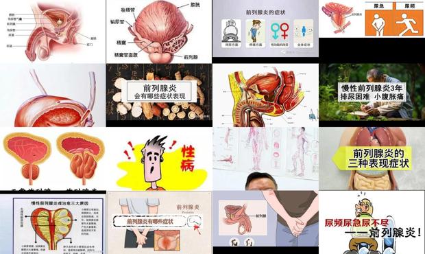 慢性前列腺世界难题 - 汕头慢性前列腺炎症状表现