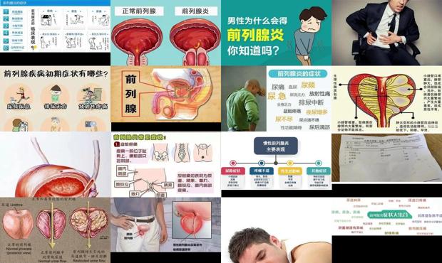 急性前列腺挂什么科 - 汕头急性前列腺炎症状是什么表现