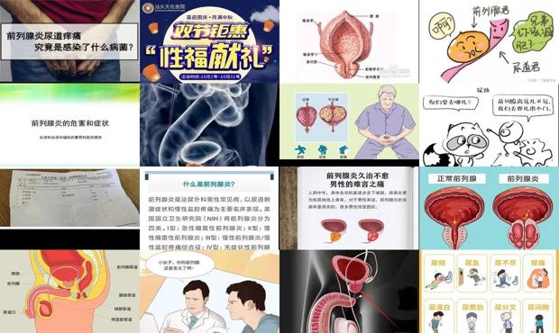 前列啥意思 - 汕头什么是前列腺炎症