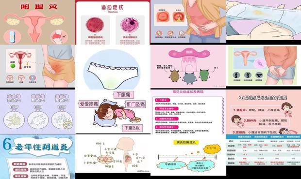 阴到炎症如何根治 - 汕头阴到炎症是什么症状