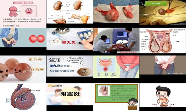 睾丸有炎症怎么办视频解说 - 汕头睾丸炎症有哪些症状