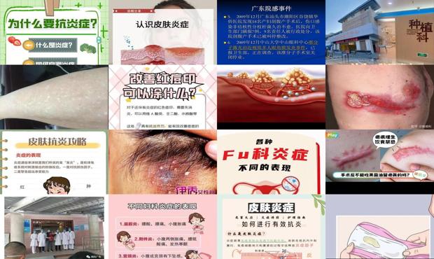 身体长期有炎症的表现 - 汕头炎症的表现