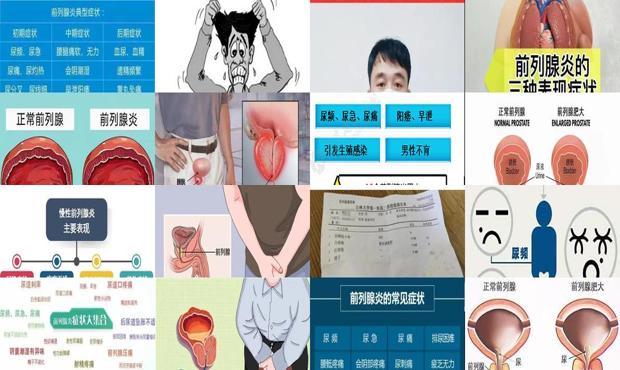 汕头是不是低风险 - 汕头如何判断前列腺炎症状