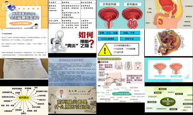 前列腺炎亲身经历 - 汕头前列腺炎怎么引起的
