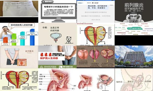 汕头哪里可以看海 - 汕头哪里看前列腺炎好
