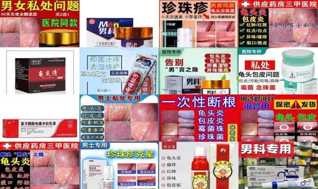 汕头最好的男科医院哪好 去哪 - 汕头龟头有炎症擦什么药