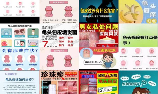 汕头最好的男科医院哪好 去哪 - 汕头龟头有点炎症怎么办