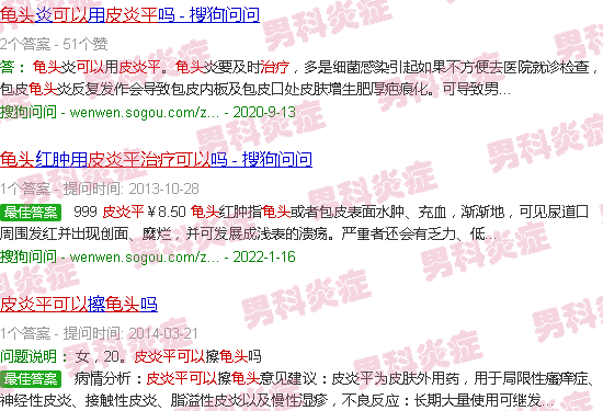 汕头皮炎平可以治疗龟头炎症吗