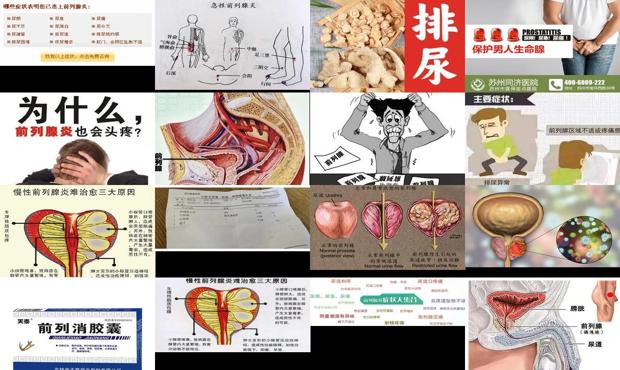 揭阳治疗前列腺炎多少钱 - 汕头前列腺炎