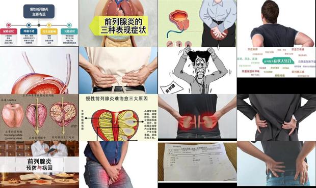前列腺炎症治疗费用大概多少怎么收费 - 汕头前列腺炎症状图片