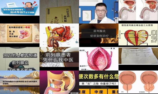 男性前列腺医院 - 汕头前列腺怎么治