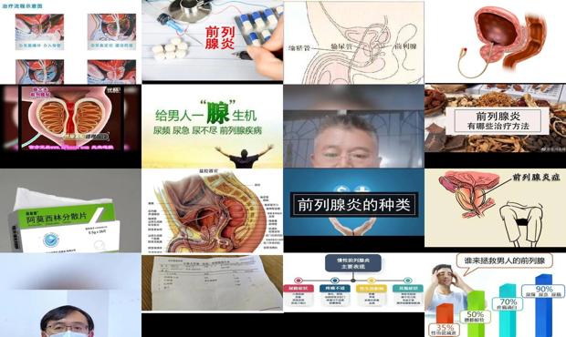 前列腺炎亲身经历 - 汕头前列腺炎如何治疗