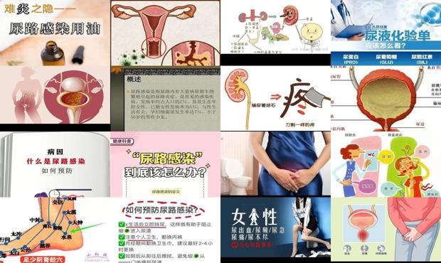 治尿路炎症中成药 - 汕头治尿路炎症妙招