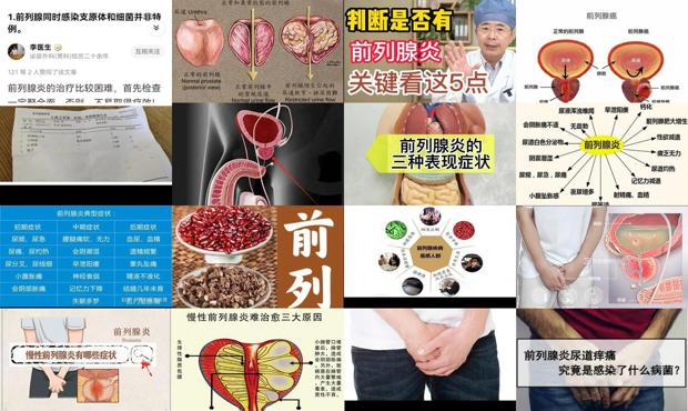 前列腺发炎怎么治疗需要多少钱 - 汕头前列腺炎什么症状