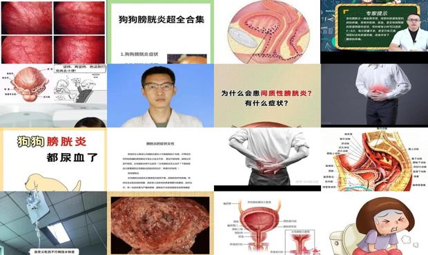 膀胱炎炎怎么治疗 - 汕头膀胱炎症状有哪些