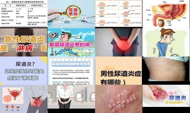汕头男性正规医院 - 汕头男性细菌性尿道炎症状