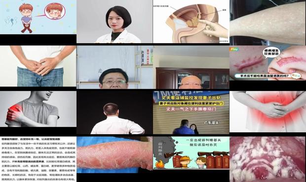 男性的炎症 - 汕头男人的炎症