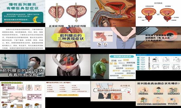 普宁前列腺炎 - 汕头前列腺炎症状表现有哪些症状
