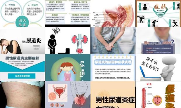 女人尿道炎的症状有哪些 - 汕头尿道炎症状表现男图片