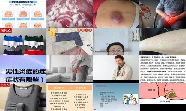 男人得了炎症怎么治疗 - 汕头男人有炎症有什么症状