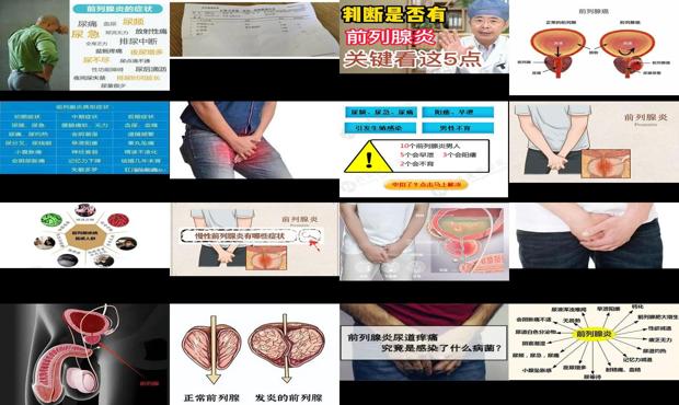 前列的含义 - 汕头什么是前列腺炎症状