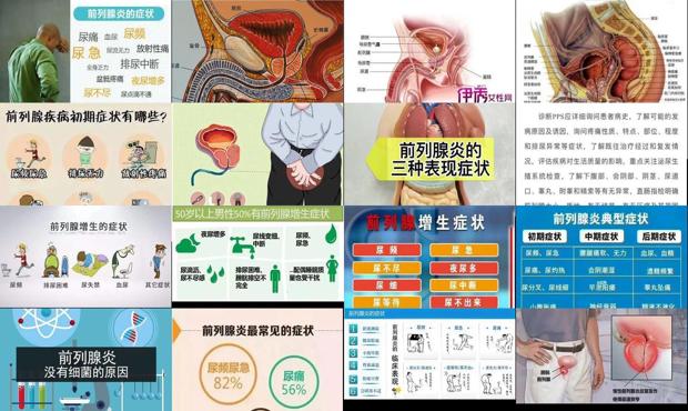 汕头中心医院前列腺检查多少钱一次 - 汕头前列腺的症状表现