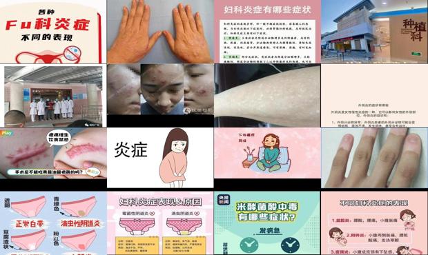 汕头肺炎确诊病例在哪治疗 - 汕头炎症有哪些症状