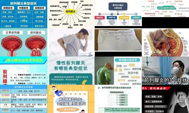 汕头男士前列腺护理 - 汕头男士前列腺炎症状有哪些
