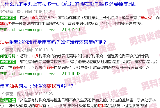 汕头睾丸炎症状的图片图库