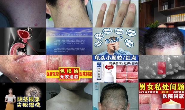 汕头有哪些男科医院 - 汕头阴茎炎症会有什么症状