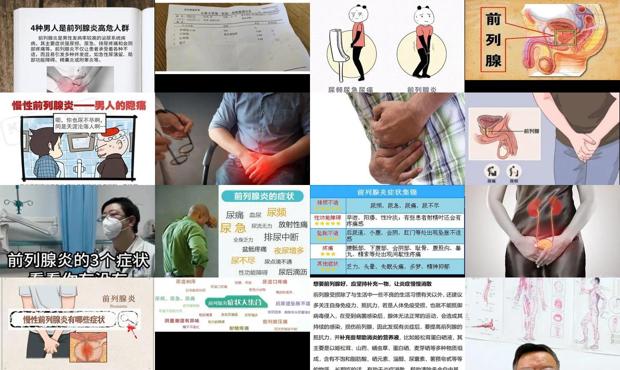 男士前列腺严重吗 - 汕头男人前列腺炎症状表现哪些症状
