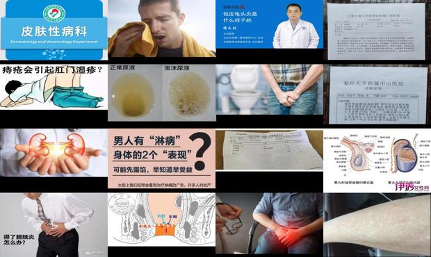 汕头男士 - 汕头男人下面有炎症是什么症状