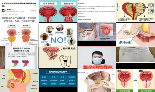 汕头经济如何发展 - 汕头如何判断自己前列腺炎