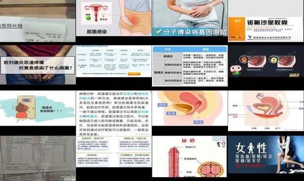 尿道发炎治疗费用 - 汕头尿道炎症怎么治疗